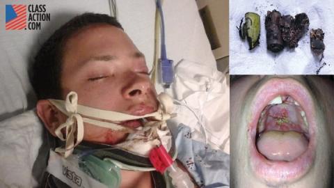 Attorneys File Product Liability Lawsuits Over Explosive E-Cigs