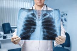 Mesothelioma Lawsuit